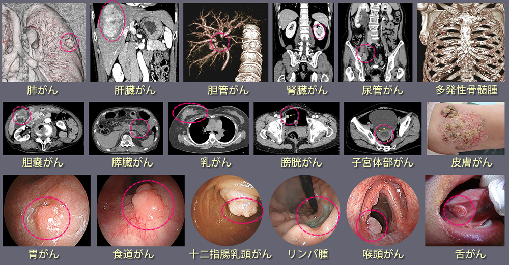 各種がん当院診断画像