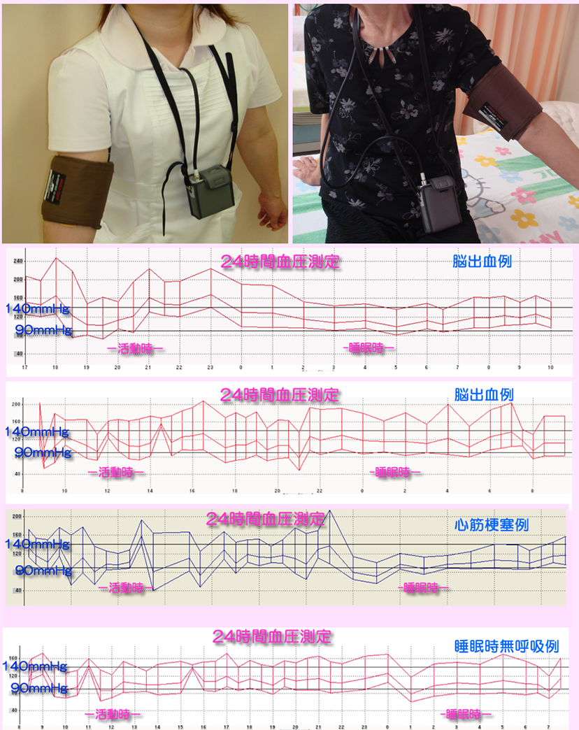 24時間血圧測定器・ABPM